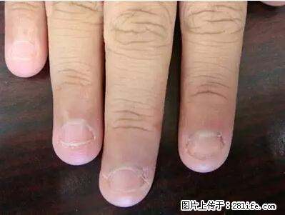 剪指甲、挖耳屎，这些日常小动作竟隐藏大危害！ - 开封生活资讯 - 开封28生活网 kaifeng.28life.net